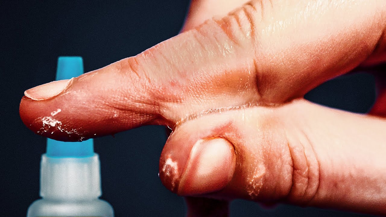 Read more about the article Why Super Glue Is Perfect For Gluing Skin Veritasium Explains